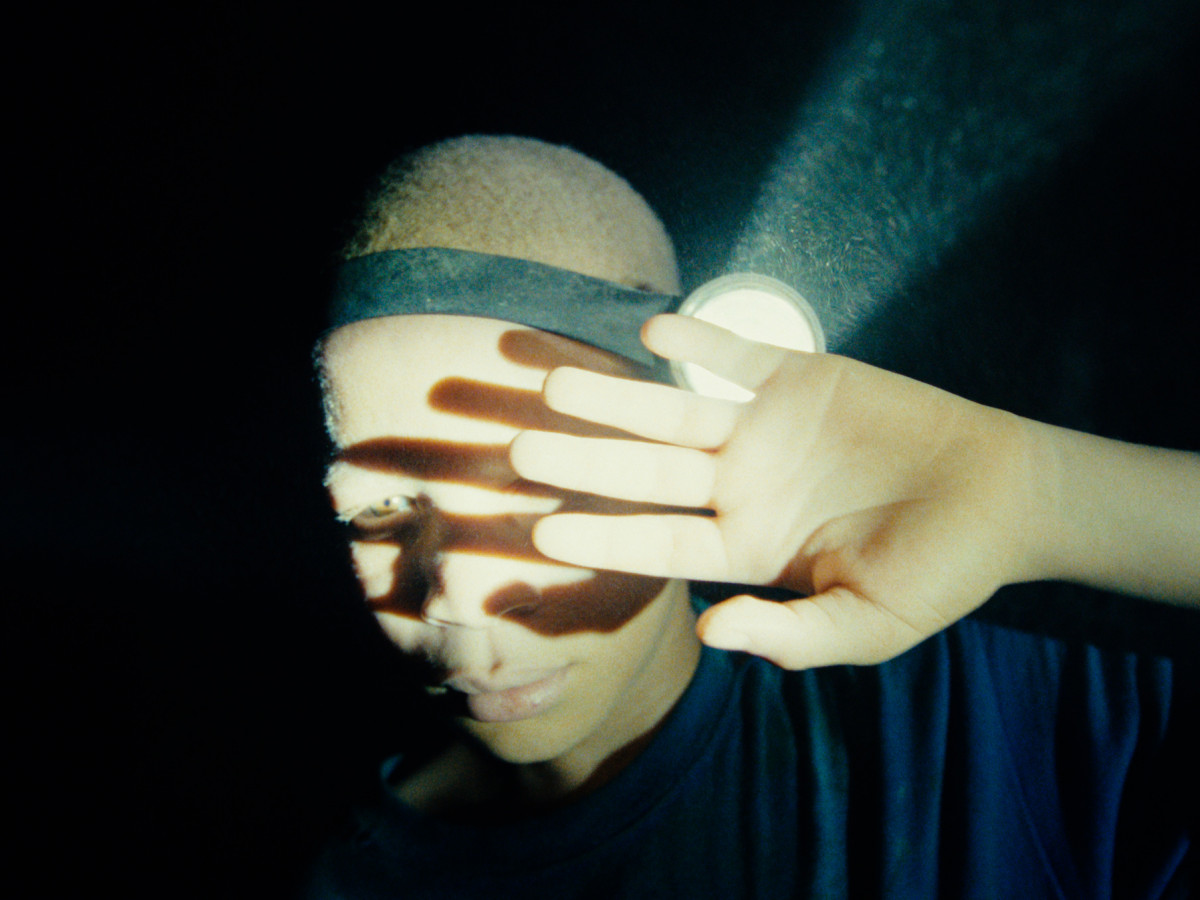 The boy with white skin